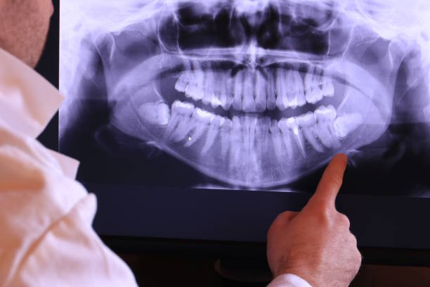 Best Emergency Dental Surgery in Claxton, GA